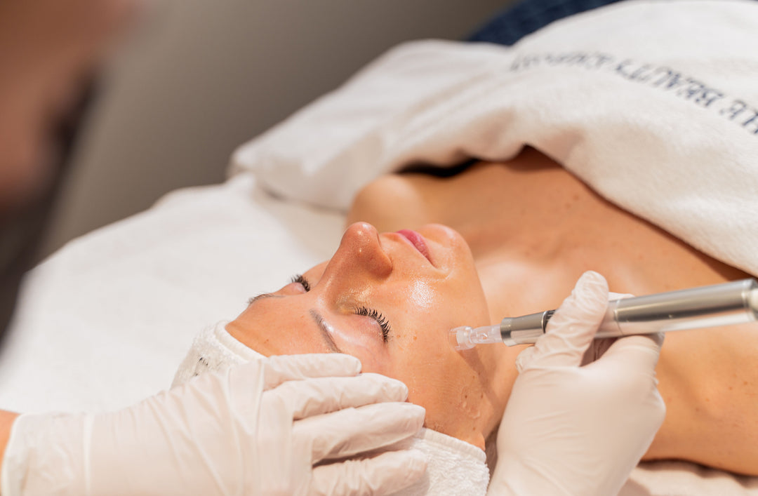 skin needling at the Beauty Embassy Gold Coast