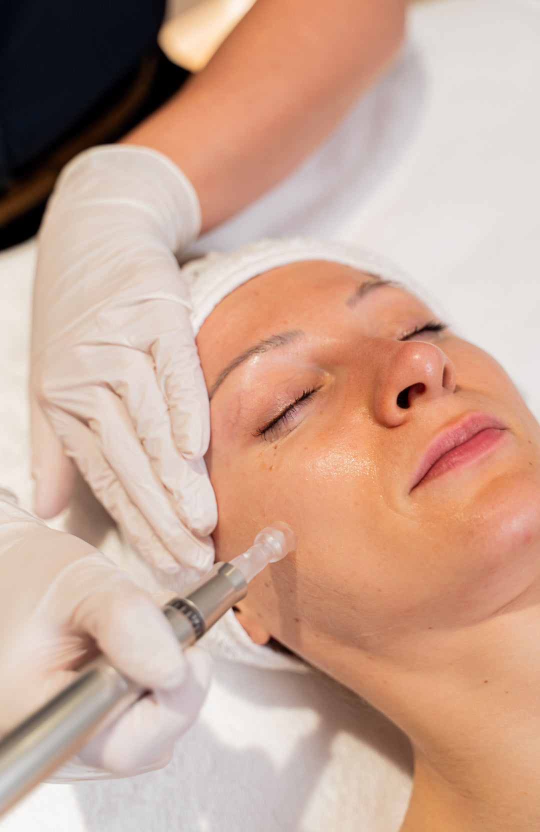 skin tone correcting facial with skin needling